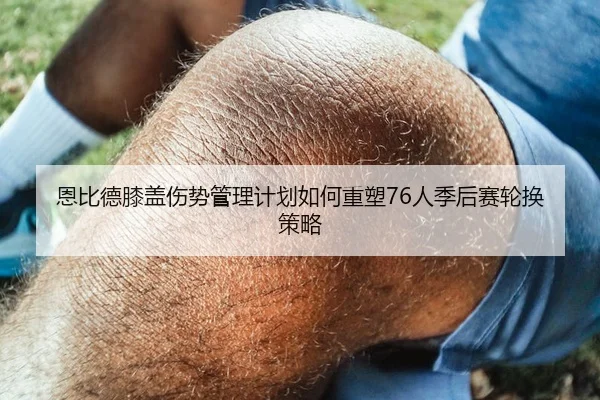 恩比德膝盖伤势管理计划如何重塑76人季后赛轮换策略